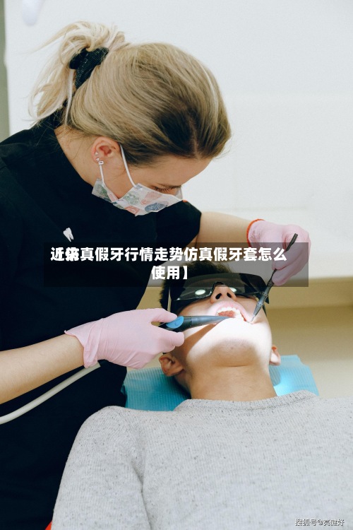 近来
【仿真假牙行情走势仿真假牙套怎么使用】-第3张图片