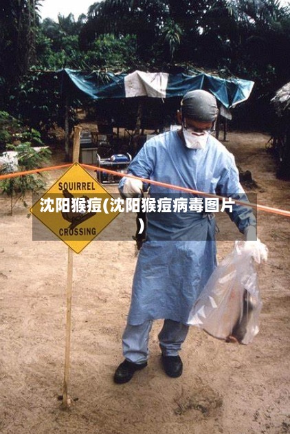 沈阳猴痘(沈阳猴痘病毒图片)-第2张图片